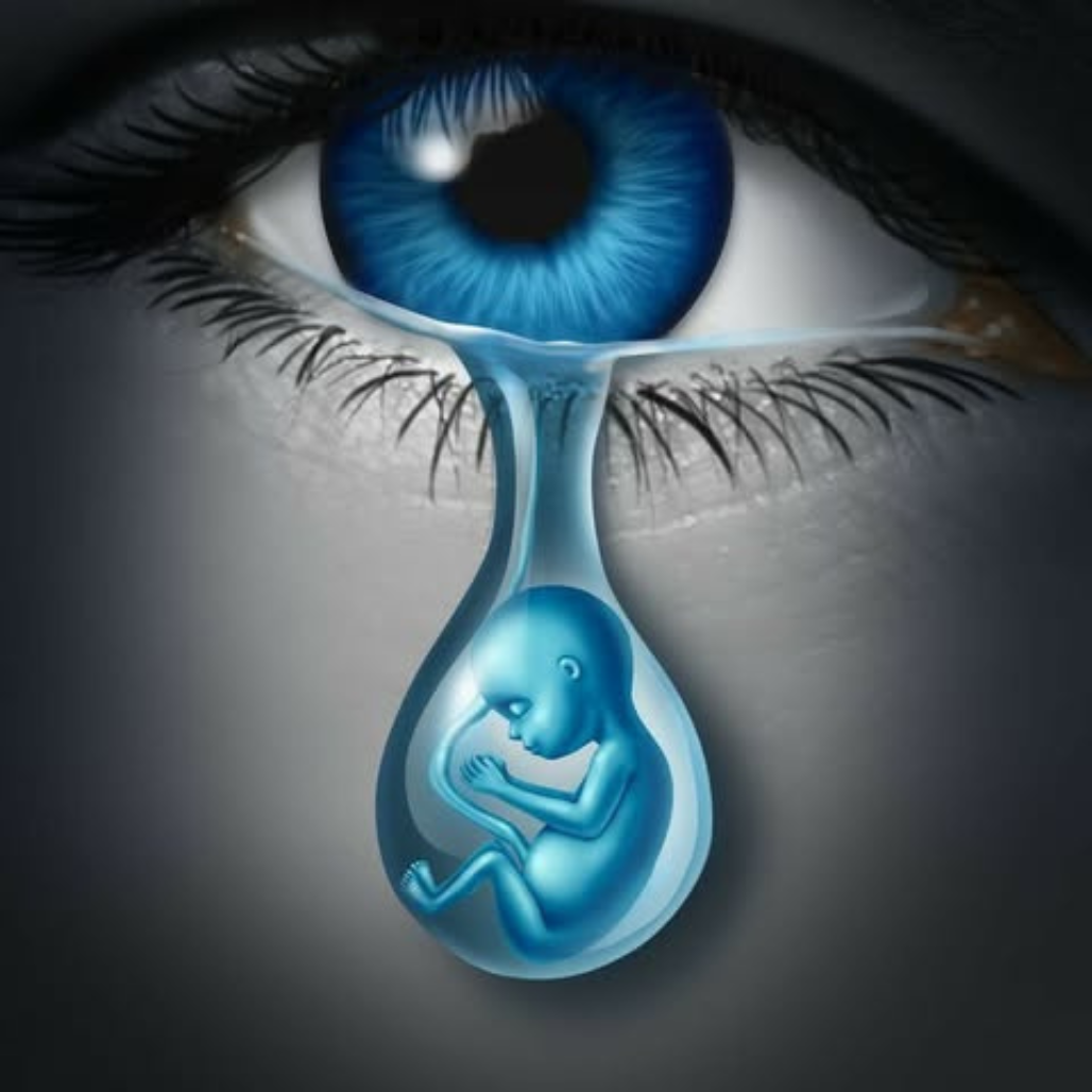 Aborto eterno